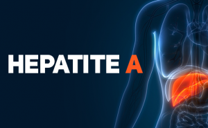 Surto ativo de hepatite A no Algarve com 25 casos registados