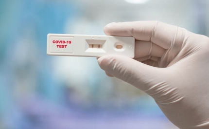 Covid-19: Farmácias garantem disponibilidade de testes apesar do aumento da procura