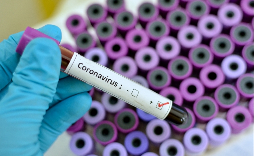 Covid-19: Sobe para 83 o número de infetados no Algarve