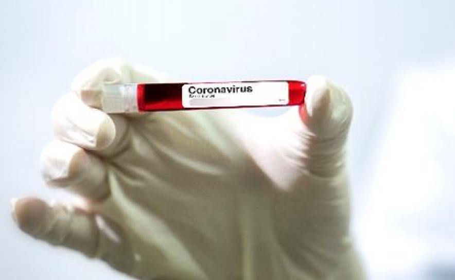 Covid-19: Algarve hoje com mais 6 casos de Coronavírus 