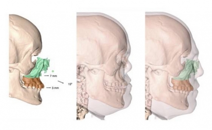 Cirurgia Inédita em Portugal 