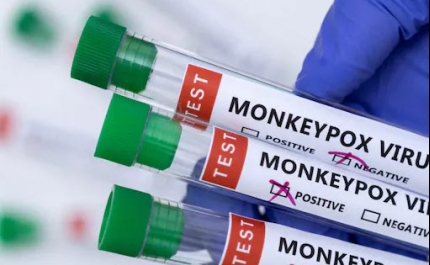 Monkeypox detetado em 29 países e já há transmissão comunitária