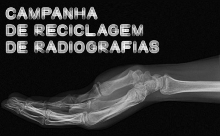 24ª edição da Campanha de Recolha de Radiografias