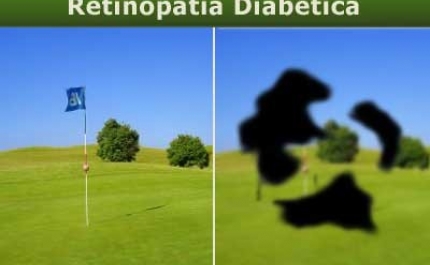 Triagem automatizada de retinopatia diabética pronta para uso clínico