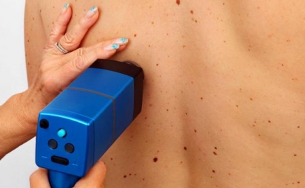 Tavira Gran-Plaza participa em ação de sensibilização - Melanoma