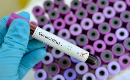 Covid-19: Portugal fez mais de 370 mil testes desde 01 de março