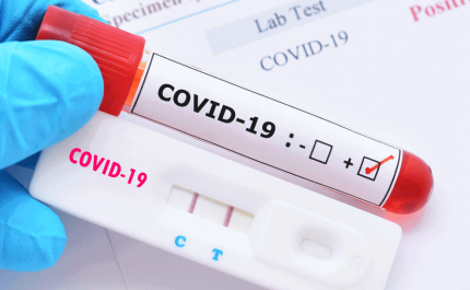 Covid-19: Média de casos baixa para as 2.527 infeções diárias