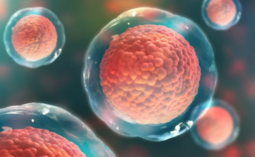 Técnica de multiplicação de células estaminais do sangue do cordão umbilical permite otimizar resultados dos transplantes