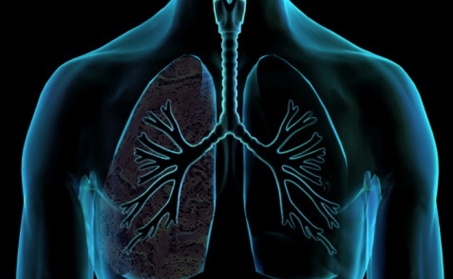 Algarve com fraca capacidade para diagnosticar doença pulmonar