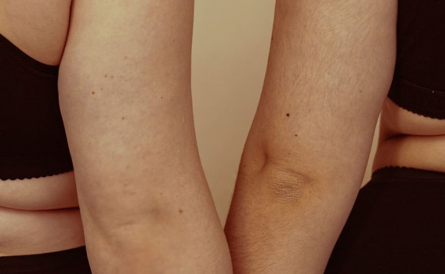 UAlg dinamiza ação de sensibilização sobre a imagem corporal