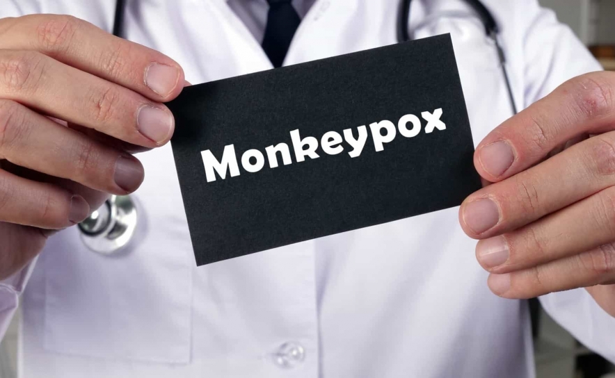 Monkeypox: DGS divulga cuidados a ter em eventos antes e após contactos sexuais